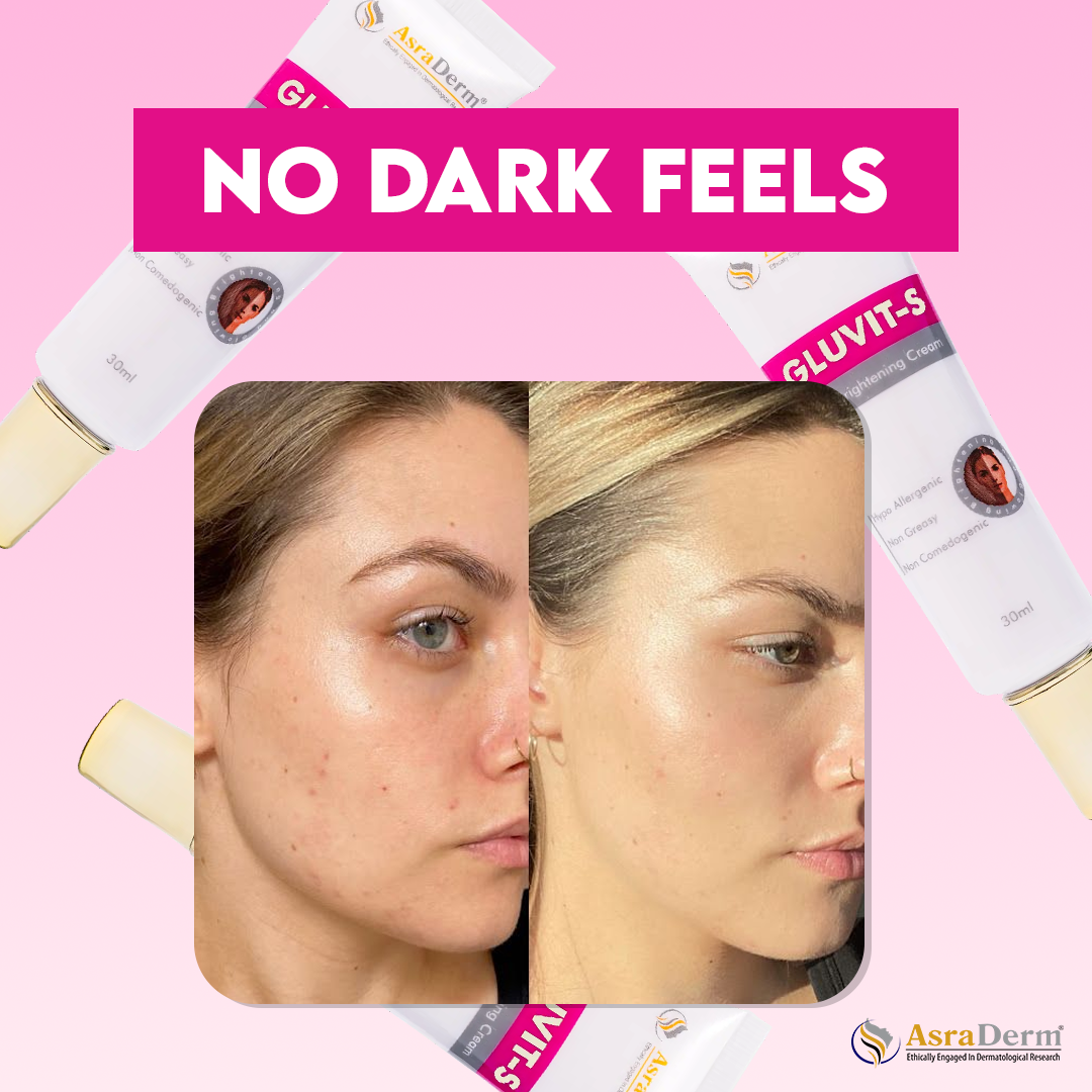 Gluvit Skin Brightening &amp; Repairing Cream