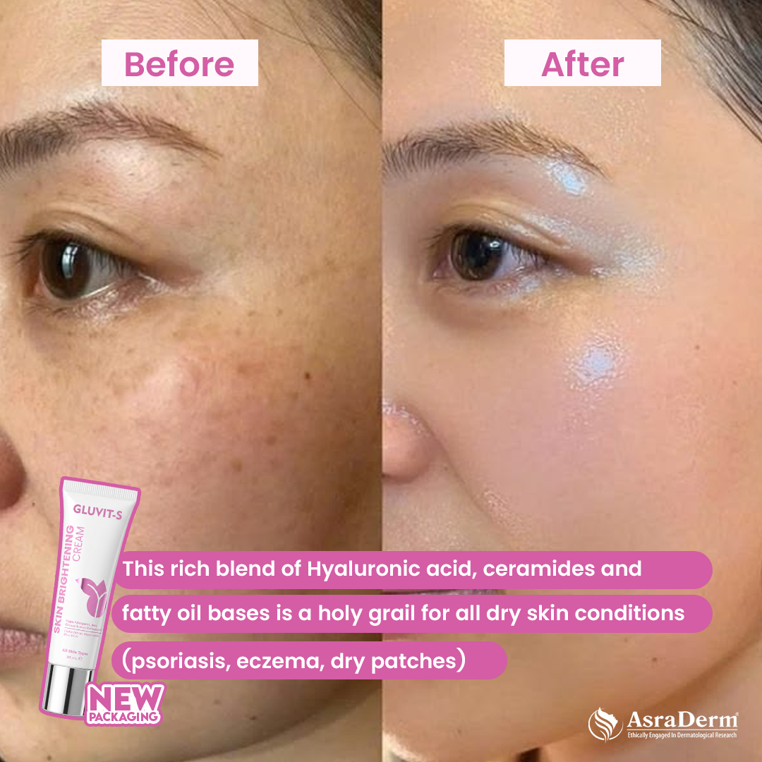 Gluvit Skin Brightening & Repairing Cream